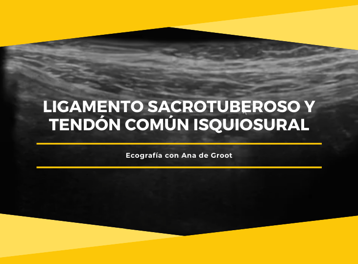 ligamento-sacrotuberoso-y-tendon-isquiosural-ecografia-con-ana-de-groot